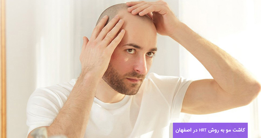 کاشت مو به روش hrt در اصفهان