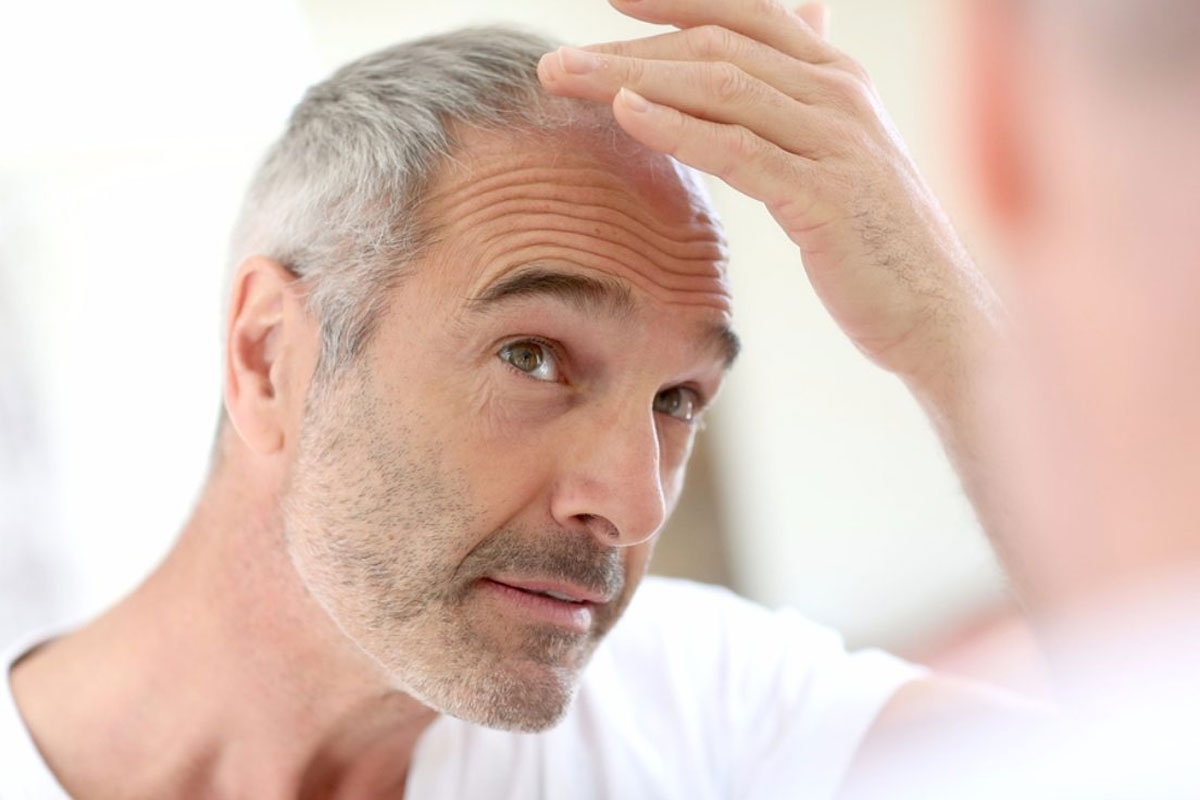 آیا جراحی کاشت مو می تواند برای شما مناسب باشد؟